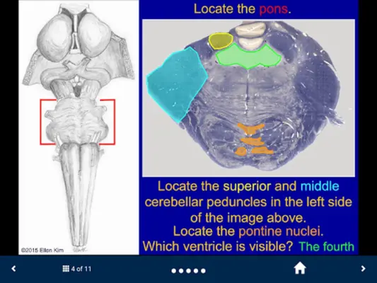 Neuroanatomy - SecondLook android App screenshot 0