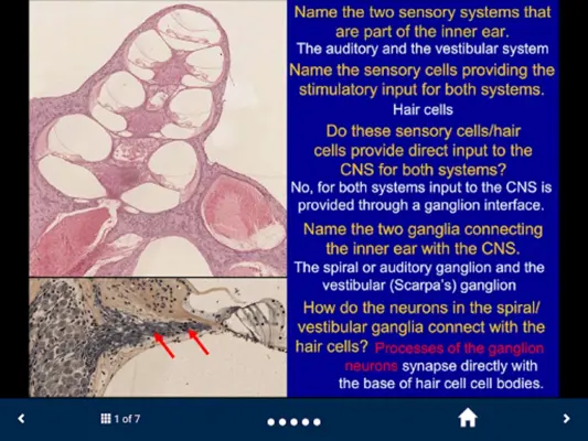 Neuroanatomy - SecondLook android App screenshot 2